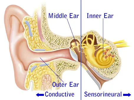 Middel Ear, Inner Ear, Outer Ear Anatomy