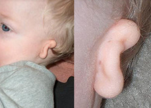 Baby Ear.