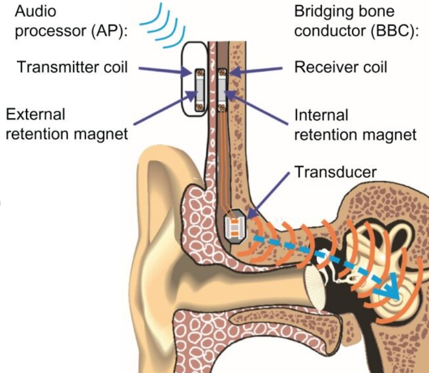 diagram of the surgery.