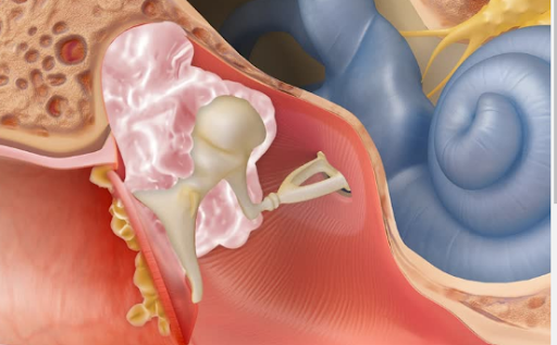 Anatomy of the ear.