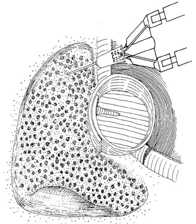 Bone Patte.