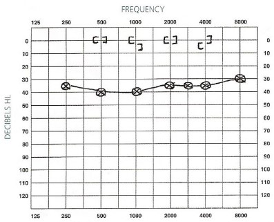 Graphs.